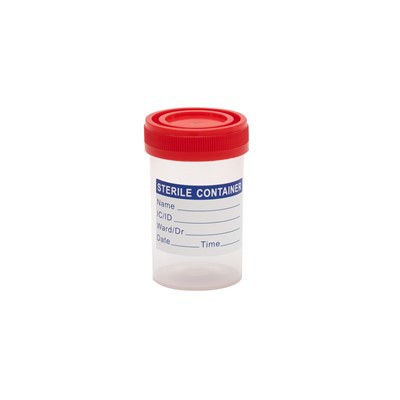 Contenedor de muestras de orina
